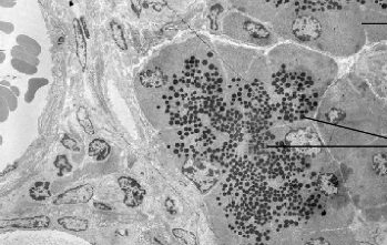 pancreatic acinar cells using exocytosis